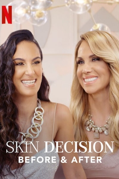 Skin Decision: Before and After - Season 1